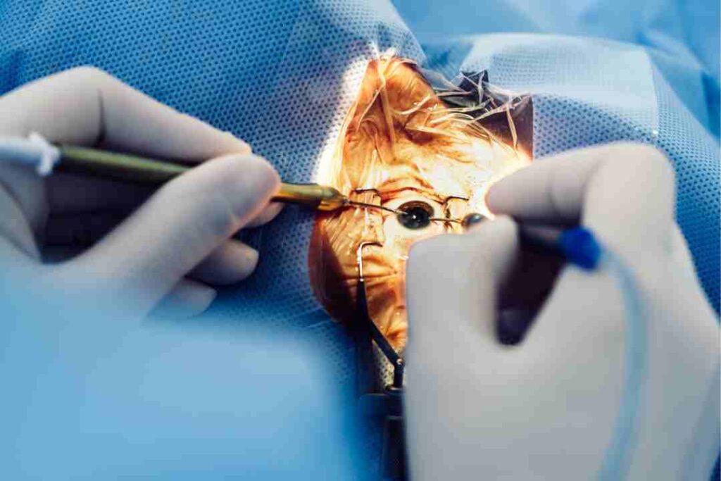 SMILE Eye Surgery Cost in Sydney: Transparent Price Breakdown
